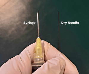 Needles used for dry needling are much thinner than syringe needles